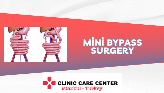 Mini Bypass Surgery