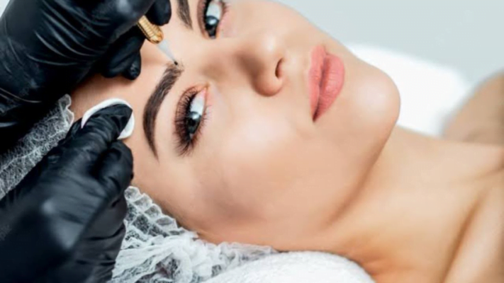 What are the Advantages of Eyebrow Transplantation?