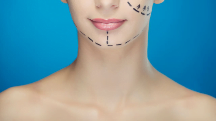 What is the Difference Between Face Rejuvenation and Face Lift Surgery?