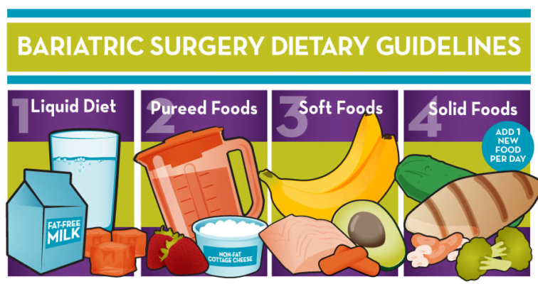 Nutrition After Sleeve Gastrectomy Surgery