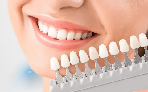 Porselen Diş Tedavisi 2022