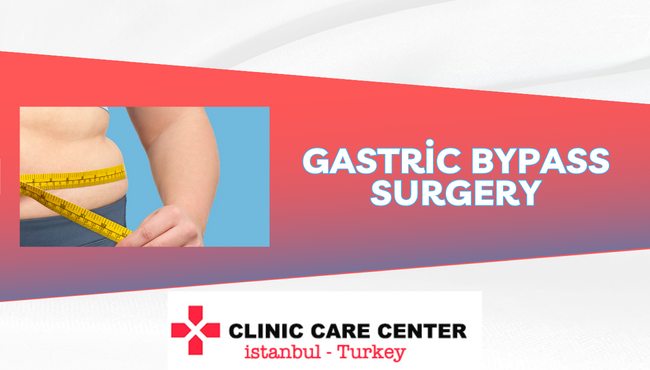 Gastric Bypass Surgery Cost
