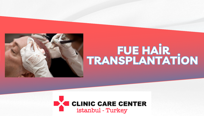 Hair Transplantation with FUE