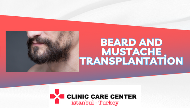 Beard and mustache transplantation