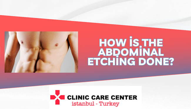 How is the abdominal etching done