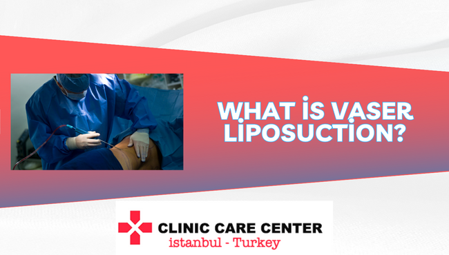 What is Vaser Liposuction