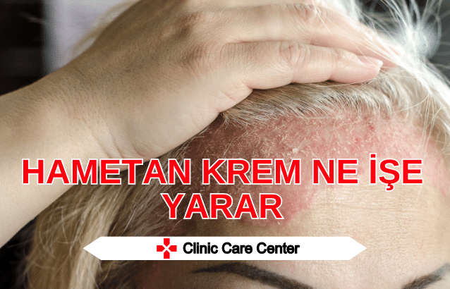 Hametan Krem Ne İşe Yarar Hametan Krem Fiyat