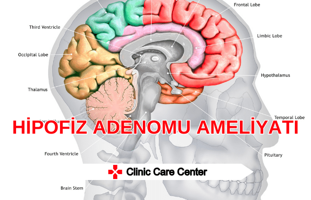 Hipofiz Adenomu Ameliyatı Olanların Yorumları