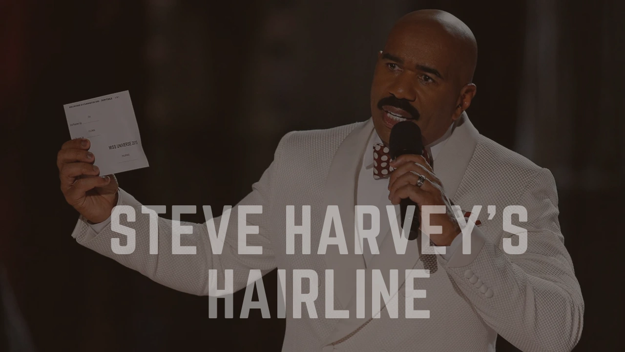 Steve Harvey’s Hairline