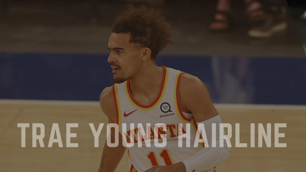 Trae Young Hairline