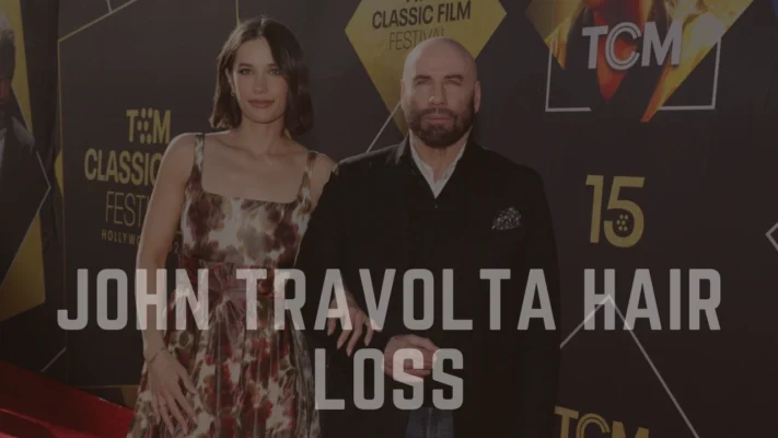 John Travolta Hair Loss