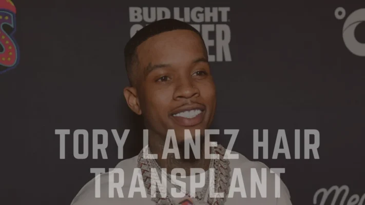 Tory Lanez Hair Transplant