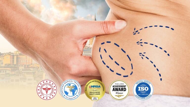 Liposucción Vaser Turquía Estambul Costo