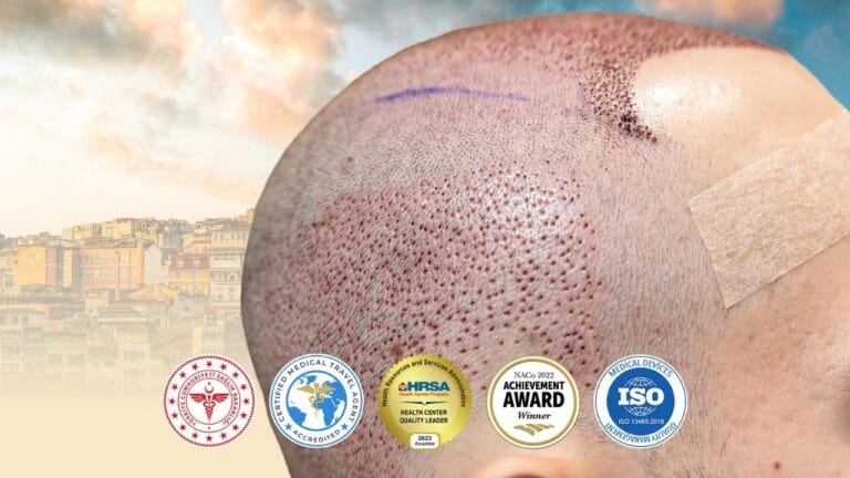 Trasplante capilar en Turquía, Estambul - Costo