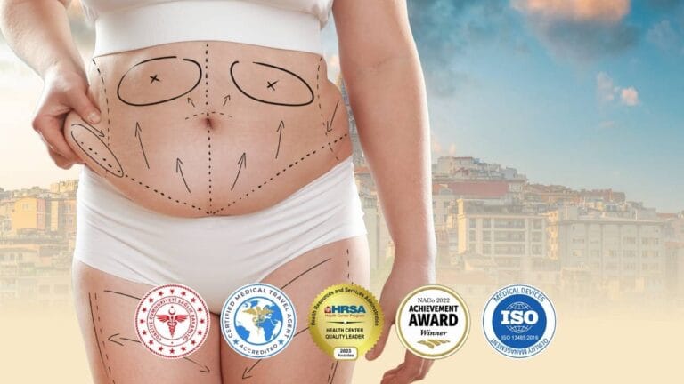 Vaser Liposuktion Türkei Kosten