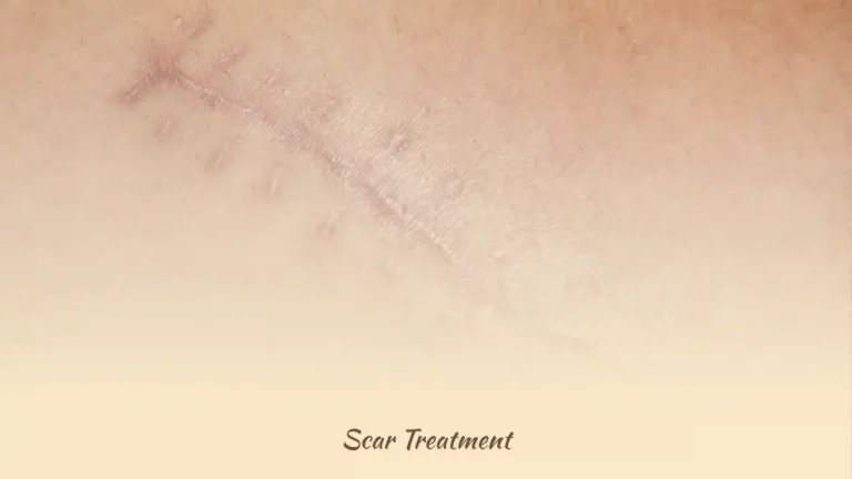 Scar Revision (Scar Treatment) in Istanbul, Turkey