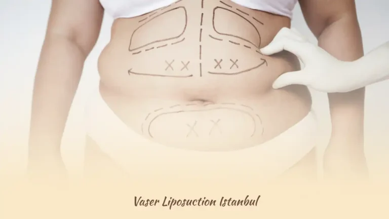 Vaser Liposuction Istanbul