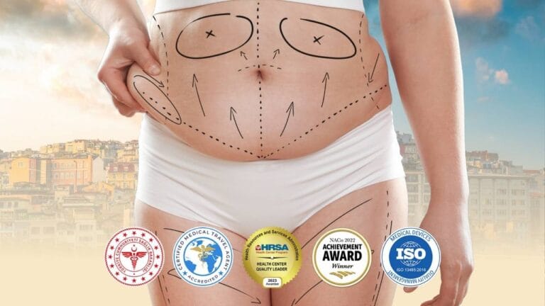 Абдоминопластика (Tummy Tuck) Турция