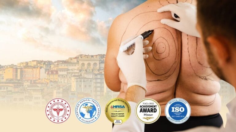 أفضل تكلفة شفط الدهون بالفيزر في تركيا إسطنبول