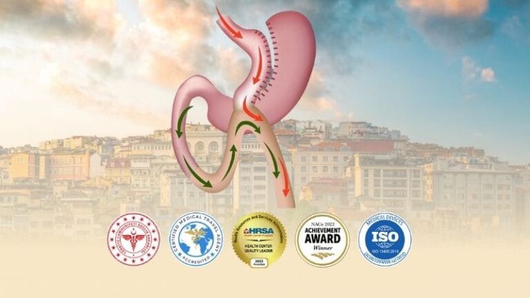 Gastric Bypass Turkey