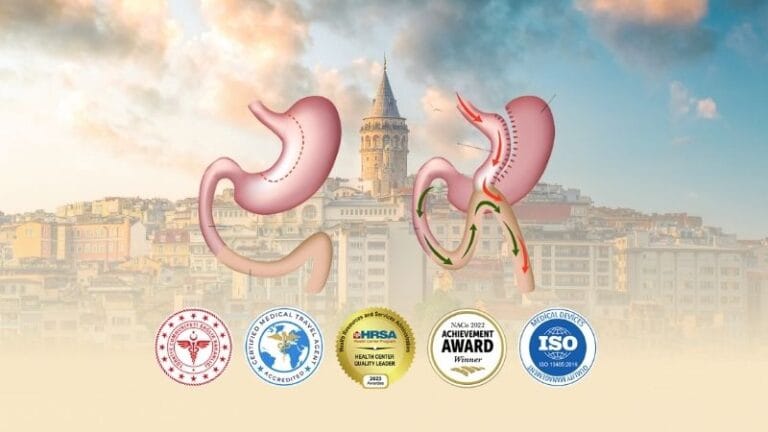 Mini Gastric Bypass in Turkey