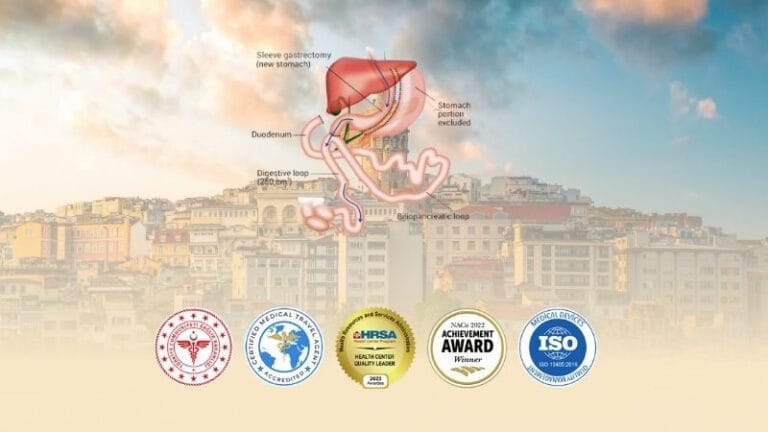 SADI-S Surgery in Turkey